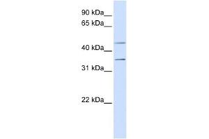 P2RY12 antibody used at 1 ug/ml to detect target protein. (P2RY12 antibody  (N-Term))