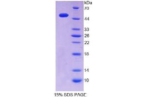 SDS-PAGE analysis of Mouse ITPA Protein.