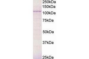 Image no. 1 for anti-Breast Cancer Anti-Estrogen Resistance 3 (BCAR3) (AA 813-825) antibody (ABIN292889)