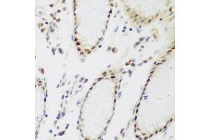 Immunohistochemistry of paraffin-embedded human stomach using PPAN antibody (ABIN5975126) at dilution of 1/200 (40x lens). (PPAN antibody)