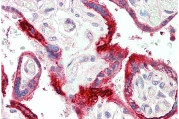 VPS51 antibody  (C-Term)