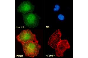 (ABIN263149) Immunofluorescence analysis of paraformaldehyde fixed A549 cells, permeabilized with 0. (ETV1 antibody  (Internal Region))