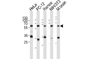 Western blot analysis of lysates from HeLa, rat PC-12, Ramos, mouse NIH/3T3 cell line, mouse brain tissue lysate(from left to right), using PKM2-N491 at 1:1000 at each lane. (Pyruvate Kinase antibody  (C-Term))