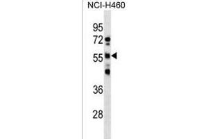 RBMY1D antibody  (C-Term)