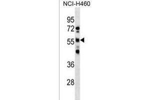 RBMY1D Antibody (C-term) (ABIN1537343 and ABIN2850417) western blot analysis in NCI- cell line lysates (35 μg/lane).