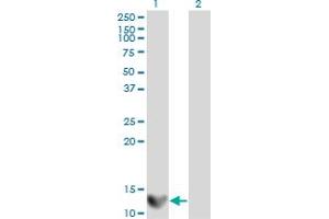 Western Blot analysis of LGALS1 expression in transfected 293T cell line by LGALS1 monoclonal antibody (M01), clone 1E8-1B2. (LGALS1/Galectin 1 antibody  (AA 1-135))