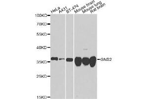 Western blot analysis of extracts of various cell lines, using GNB2 antibody. (GNB2 antibody)