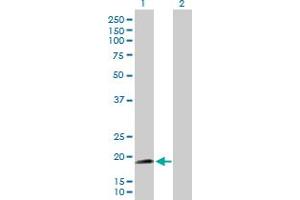 Western Blot analysis of NNT expression in transfected 293T cell line by NNT MaxPab polyclonal antibody. (NNT antibody  (AA 1-207))