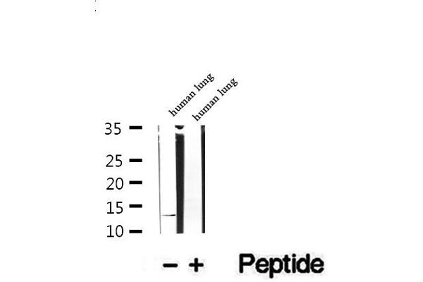DNAJC19 antibody  (Internal Region)