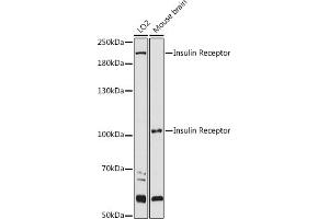 Western blot analysis of extracts of various cell lines, using Insulin Receptor antibody (ABIN3020883, ABIN3020884, ABIN3020885 and ABIN6213774) at 1:1000 dilution. (Insulin Receptor antibody  (AA 1130-1230))