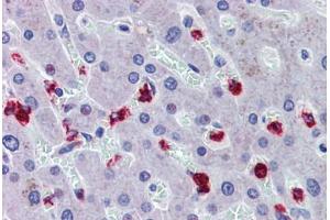Liver, Human: Formalin-Fixed, Paraffin-Embedded (FFPE) (RASSF2 antibody  (AA 11-22))