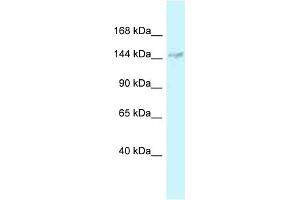 WB Suggested Anti-DHX38 Antibody Titration: 1. (DHX38 antibody  (Middle Region))
