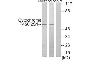 Immunohistochemistry analysis of paraffin-embedded human lung carcinoma tissue using Cytochrome P450 2S1 antibody. (CYP2S1 antibody)