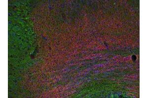 Indirect immunostaining of PFA fixed section of triangular nucleus of septum with anti-EPS 8 (dilution 1 : 200; red) and mouse anti-α-tubulin (ABIN1742547, dilution 1 : 200; green).
