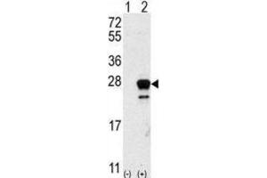 Western Blotting (WB) image for anti-GTPase NRas (NRAS) antibody (ABIN5023677) (GTPase NRas antibody)