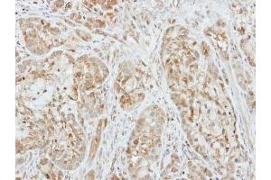 IHC-P Image Immunohistochemical analysis of paraffin-embedded A549 xenograft, using Factor X, antibody at 1:500 dilution. (Coagulation Factor X antibody)