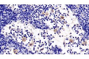 Detection of TLR5 in Rat Lymph node Tissue using Monoclonal Antibody to Toll Like Receptor 5 (TLR5) (TLR5 antibody  (AA 693-858))