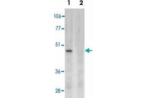 Western blot analysis of CD209 expression in human placenta tissue lysate in the absence (lane 1) and presence (lane 2) of blocking peptide with CD209 polyclonal antibody  at 2 ug /mL . (DC-SIGN/CD209 antibody  (Internal Region))