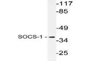 Western blot analysis of SOCS-1 in extracts from Jurkat cells using SOCS1 / JAB antibody . (SOCS1 antibody)