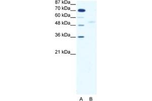 Western Blotting (WB) image for anti-SMAD, Mothers Against DPP Homolog 5 (SMAD5) antibody (ABIN2460352) (SMAD5 antibody)
