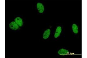 Immunofluorescence of monoclonal antibody to PHIP on HeLa cell.