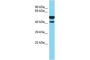 Host: Rabbit Target Name: CBWD2 Sample Type: Fetal Kidney lysates Antibody Dilution: 1. (CBWD2 antibody  (C-Term))