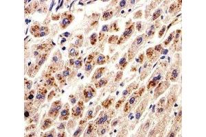 IHC analysis of FFPE human liver section using DHFR antibody; Ab was diluted at 1:25. (Dihydrofolate Reductase antibody  (AA 1-50))
