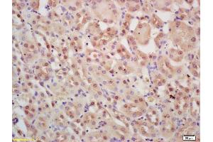 Formalin-fixed and paraffin embedded mouse kidney labeled with Rabbit Anti INTS3 Polyclonal Antibody, Unconjugated (ABIN1387357) at 1:200 followed by conjugation to the secondary antibody and DAB staining (INTS3 antibody  (AA 960-998))