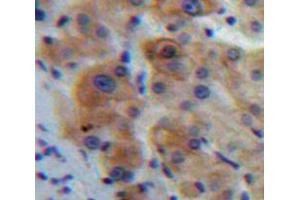 IHC-P analysis of Liver tissue, with DAB staining. (IL1R1 antibody  (AA 20-338))