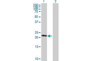 Western Blot analysis of VASH1 expression in transfected 293T cell line by VASH1 MaxPab polyclonal antibody. (VASH1 antibody  (AA 1-204))