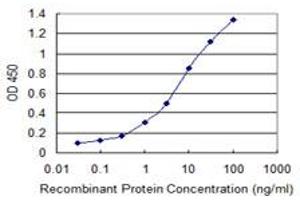 Detection limit for recombinant GST tagged LRRK1 is 0. (LRRK1 antibody  (AA 560-659))