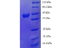 SDS-PAGE (SDS) image for Tumor Necrosis Factor alpha (TNF alpha) (AA 78-234) protein (GST tag) (ABIN5710518)