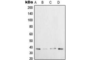 Western blot analysis of XRCC3 expression in HeLa (A), H1299 (B), U2OS (C), HepG2 (D) whole cell lysates. (XRCC3 antibody  (Center))
