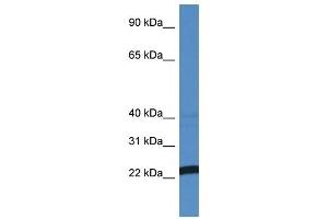 Western Blot showing EFNA4 antibody used at a concentration of 1 ug/ml against MCF7 Cell Lysate (EFNA4 antibody  (N-Term))