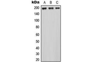 Western blot analysis of MRCK alpha expression in HEK293T (A), NS-1 (B), PC12 (C) whole cell lysates.