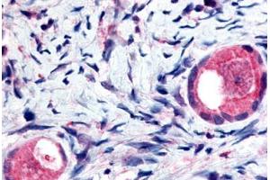 Human Ovary, Oocytes (formalin-fixed, paraffin-embedded) stained with TMEM5 antibody ABIN213420 at 5 ug/ml followed by biotinylated goat anti-rabbit IgG secondary antibody ABIN481713, alkaline phosphatase-streptavidin and chromogen. (TMEM5 antibody  (Extracellular Domain))