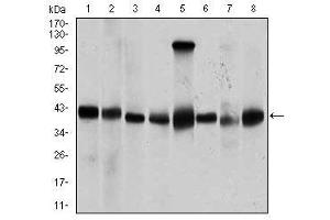 Image no. 2 for anti-Protein Phosphatase, Mg2+/Mn2+ Dependent, 1A (PPM1A) antibody (ABIN1491178) (PPM1A antibody)