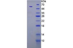 SDS-PAGE analysis of Rat Parathyroid Hormone Protein. (PTH Protein)