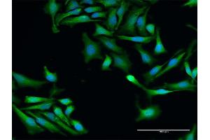 Immunofluorescence of purified MaxPab antibody to SRP19 on HeLa cell.