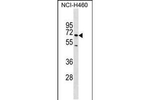Western blot analysis in NCI-H460 cell line lysates (35ug/lane). (Selectin E/CD62e antibody)