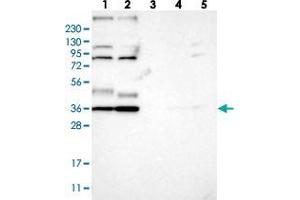 Western blot analysis of Lane 1: RT-4, Lane 2: U-251 MG, Lane 3: Human Plasma, Lane 4: Liver, Lane 5: Tonsil with YIPF2 polyclonal antibody  at 1:250-1:500 dilution. (YIPF2 antibody)