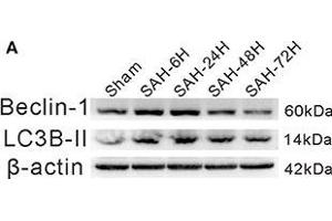 The time courses of autophagy in EBI after experimental SAH. (LC3B antibody)