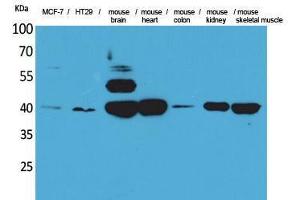 Western Blotting (WB) image for anti-Isocitrate Dehydrogenase 3 (NAD+) alpha (IDH3A) (Internal Region) antibody (ABIN3178348) (IDH3A antibody  (Internal Region))