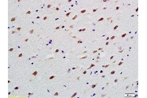 Formalin-fixed and paraffin embedded rat brain labeled with Anti-TUBB3 Polyclonal Antibody, Unconjugated  at 1:200 followed by conjugation to the secondary antibody and DAB staining (TUBB3 antibody  (AA 401-450))