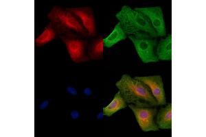 ABIN6257242 and ABIN6273630 staining  cells by IF/ICC.