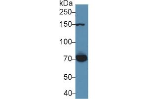 Detection of THBS1 in Rat Serum using Polyclonal Antibody to Thrombospondin 1 (THBS1) (Thrombospondin 1 antibody  (AA 71-259))