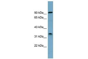 SDS antibody used at 1 ug/ml to detect target protein. (serine Dehydratase antibody  (Middle Region))