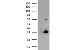 Image no. 1 for anti-Fetal and Adult Testis Expressed 1 (FATE1) antibody (ABIN1498221) (FATE1 antibody)