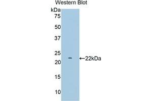 Detection of Recombinant PYGM, Mouse using Polyclonal Antibody to Glycogen Phosphorylase, Muscle (PYGM) (PYGM antibody  (AA 11-187))