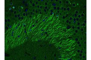 Indirect immunofluorescence labeling of PFA fixed, paraffin embedded mouse hippocampus section (dilution 1 : 500; green). (tau antibody  (AA 3-214))
